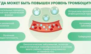 Повышенные тромбоциты в крови у женщин. Причины и лечение, что это значит