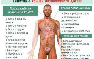 Уколы при защемлении нерва в пояснице и грыжах в позвоночнике