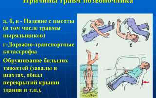 Травмы позвоночника. Первая помощь, классификация, симптомы