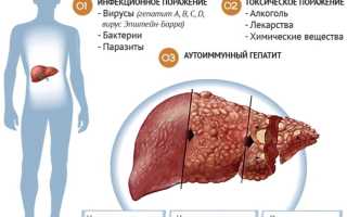 Заболевания печени у женщин. Причины, симптомы и лечение
