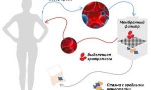 Чистка крови и лимфы в домашних условиях. Народные средства, травы, препараты, продукты питания. Советы врачей
