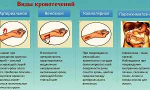 Паренхиматозное кровотечение. Это какое, определение