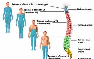 Ушиб поясничного отдела позвоночника. Симптомы, лечение у взрослых