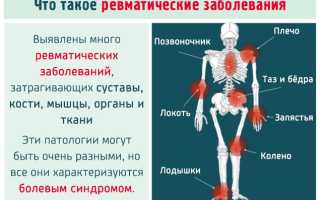 Анализ на ревмопробы. Цена, что показывает, расшифровка, как сдавать, подготовка