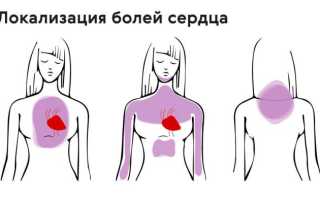 Невралгия в области сердца. Симптомы и лечение