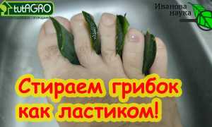 Рецепты народной медицины: Как вылечить грибок ногтей за один раз