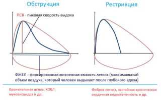 Рестрикция дыхательных путей. Что это такое, спирография, причины и лечение