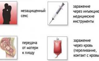 Цитомегаловирус: что это такое. Что значит положительный анализ. Симптомы, лечение. Как передается, проявляется, чем опасен, последствия