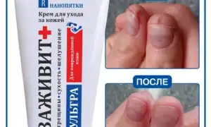 Мазь от трещин на руках, пальцах с заживляющим эффектом