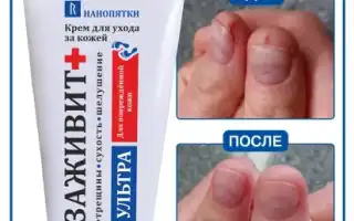 Мазь от трещин на руках, пальцах с заживляющим эффектом