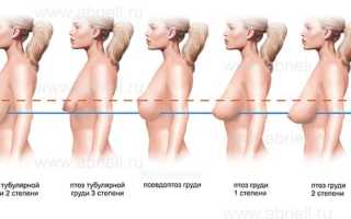 Нормальная женская грудь: размеры, как выглядит, форма, обхват