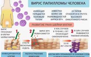 Жидкостная цитология шейки матки. Что это такое, расшифровка результатов, таблица, как берется, что показывает