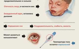 Паракоклюш. Симптомы у детей, взрослых, что это такое, признаки, лечение