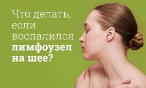 Компресс для горла при ангине, воспалении лимфоузлов на шее