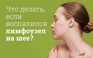 Компресс для горла при ангине, воспалении лимфоузлов на шее
