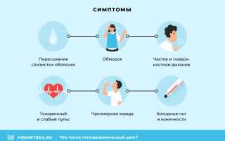 Гиповолемический шок. Что это такое, патогенез, причины