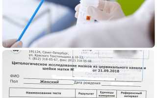 Онкоцитология шейки матки. Что это такое, результаты, расшифровка анализа, цена. Как подготовиться, сдавать, что показывает, сколько делается