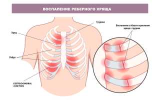 Болят ребра с двух сторон, с правой стороны при нажатии. Что делать