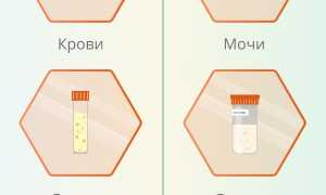 Анализ на ИППП (инфекции передаваемые половым путем). Цена, как берут у женщин, мужчин