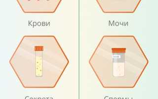 Анализ на ИППП (инфекции передаваемые половым путем). Цена, как берут у женщин, мужчин