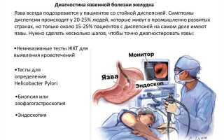 Язва желудка. Симптомы и проявление у взрослых, лечение, процедуры, операция