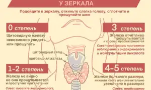 Узлы в щитовидной железе. Опасность, размер, норма, лечение