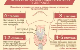 Узлы в щитовидной железе. Опасность, размер, норма, лечение