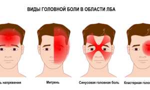 Головные боли у подростка. Часто болит голова в области лба