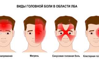 Головные боли у подростка. Часто болит голова в области лба