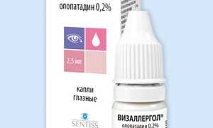 Визаллергол (Vizallergol) глазные капли. Инструкция по применению, цена