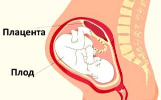 Отслойка плаценты на ранних и поздних сроках беременности. Симптомы, причины и последствия. Чем опасна, как происходит, лечение