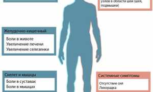 Токсоплазмоз у женщин. Симптомы и лечение
