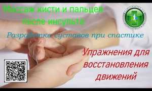 Массаж рук и ног после инсульта в домашних условиях