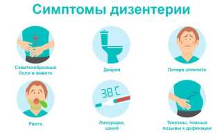 Боли в животе при дизентерии. Характер, где локализуются