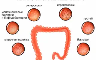 Дисбиоз кишечника. Что это такое у женщин, мужчин и детей. Симптомы и лечение