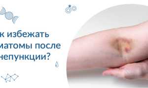 Боль после сдачи крови из вены в руке. Что делать
