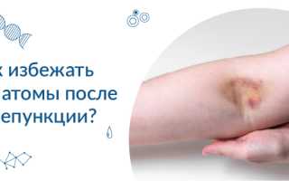 Боль после сдачи крови из вены в руке. Что делать