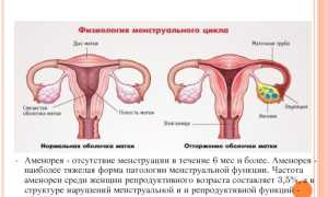 Лактационная аменорея. Что это такое, лечение