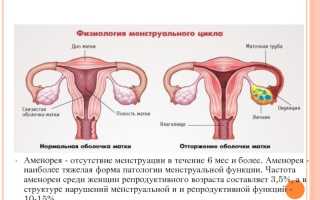 Лактационная аменорея. Что это такое, лечение