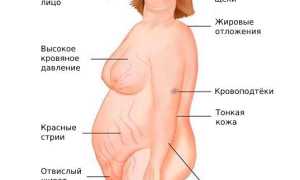 Гиперандрогения у женщин. Что это, симптомы, лечение