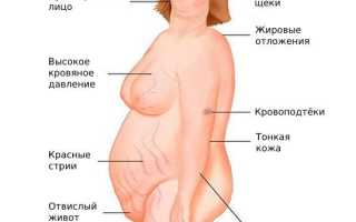 Гиперандрогения у женщин. Что это, симптомы, лечение
