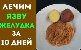 Лечение желудка народными средствами. Самые эффективные рецепты от эрозии, язвы, гастрита. Диета, очищение