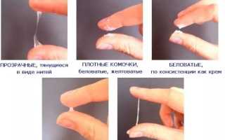 Выделения как слизь прозрачная тянущаяся. Что это значит после, перед месячными, лечение