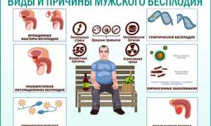 Мужское бесплодие. Лечится или нет, причины, симптомы