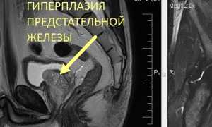 Органы малого таза у мужчин. Что входит, анатомия, МРТ, УЗИ