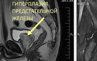 Органы малого таза у мужчин. Что входит, анатомия, МРТ, УЗИ