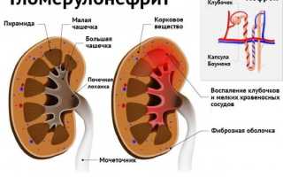 Болит почка с левой стороны. Что это может быть, причины, симптомы и лечение