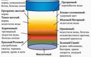 Красная моча у женщины. Причины боли, после 40-50 лет, с осадком, сгустки, при беременности