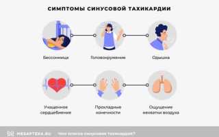 Синусовая тахикардия сердца. Что это такое, симптомы, как лечить у женщин, детей