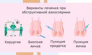 Отсутствие эякуляции (нет спермы, не выделяется). Лечение аспермии у мужчин